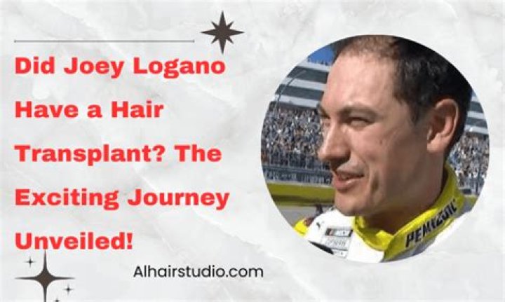 Joey Logano's Journey And Hair Piece Solutions