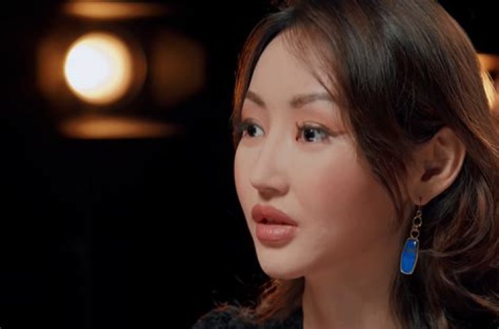 Unveiling Yeonmi Park's Plastic Surgery: Insights And Revelations