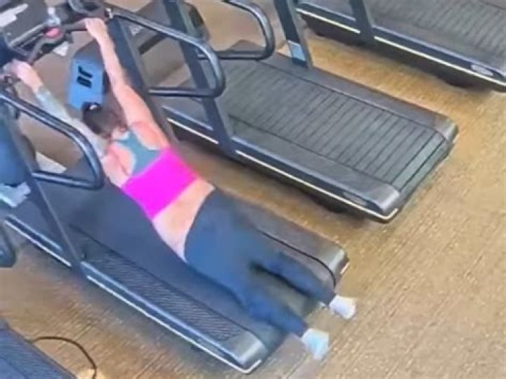 Woman Alyssa Konkel Treadmill Accident Loses Her